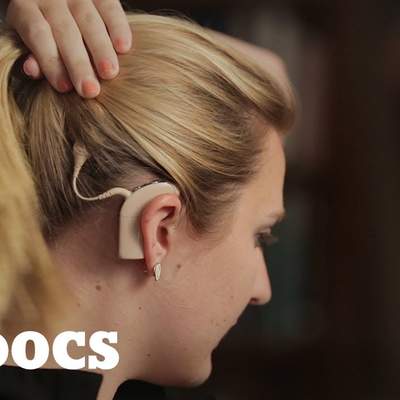 Between Sound &amp; Silence: How Technology is Changing Deafness | Op-Docs