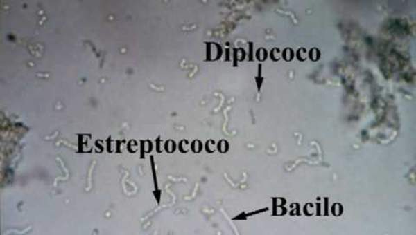 Bacterias del yogurt. Observación real al microscopio.