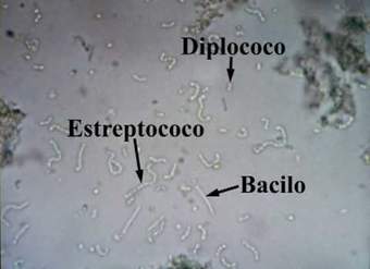 Bacterias del yogurt. Observación real al microscopio.