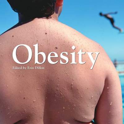 Obesity