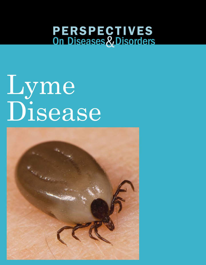 Lyme Disease, If left untreated Lyme Disease can spread to joints, heart, and nervous system. This guidebook provides essential information on the disease, but also serves as a historical survey, by providing information on the controversies surrounding its causes, and first-person narratives by people coping with it.