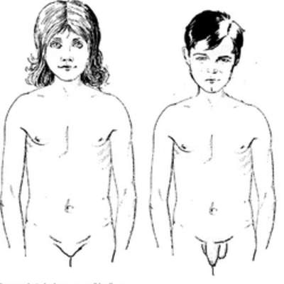 Cuerpo de niños púberes