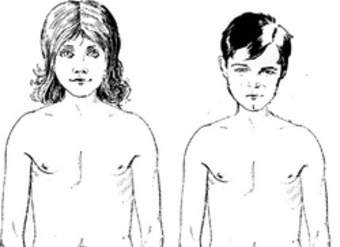 Cuerpo de niños púberes