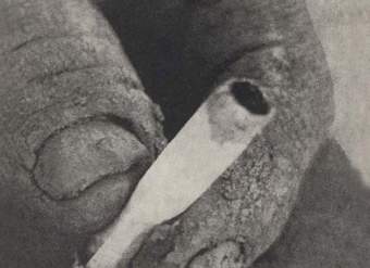 Nudo ciego : (programa)