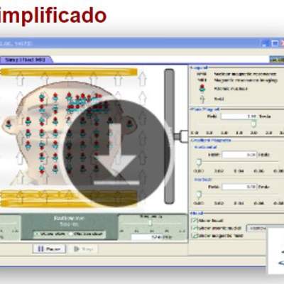 MRI Simplificado