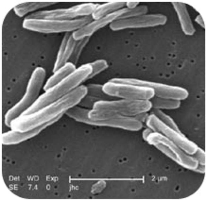 Bacteria dañina Bacteria dañina