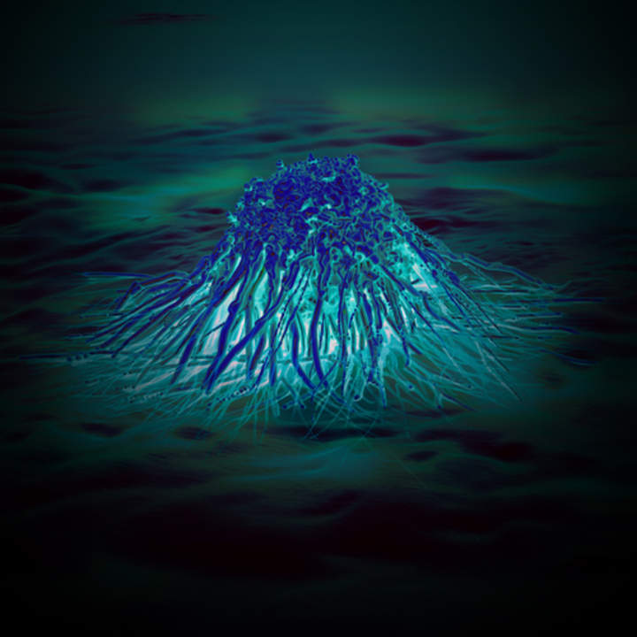Mutaciones y Cáncer - Avanzado Mutaciones y Cáncer - Avanzado