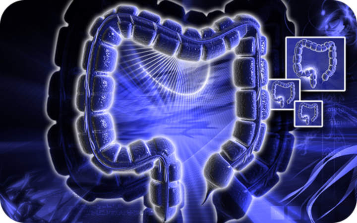 El intestino grueso - Avanzado El intestino grueso - Avanzado