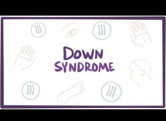Síndrome de Down (trisomía 21): causas, síntomas, diagnóstico y patología