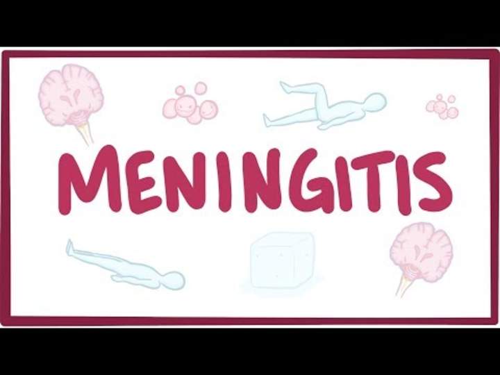 Meningitis: causas, síntomas, diagnóstico, tratamiento, patología. Meningitis: causas, síntomas, diagnóstico, tratamiento, patología.
