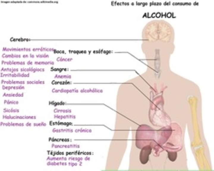 Imagen con información sobre los efectos a largo plazo del alcohol