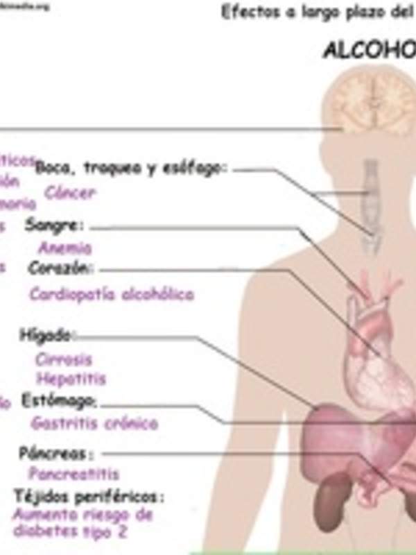 Imagen con información sobre los efectos a largo plazo del alcohol