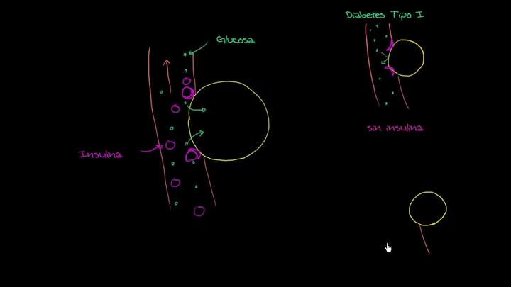 Glucosa, insulina y diabetes