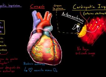 ¿Qué es el síndrome coronario agudo?