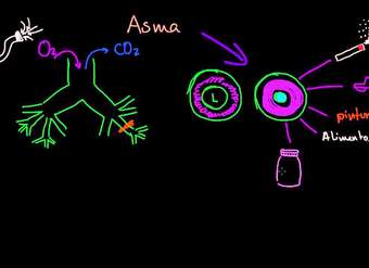 ¿Qué es el asma?