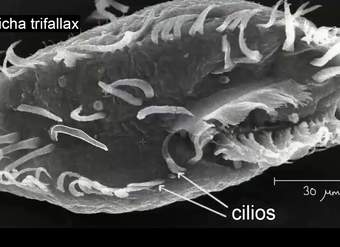 Introducción a los cilios, flagelos y seudópodos | Khan Academy en Español