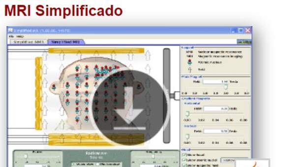 MRI Simplificado