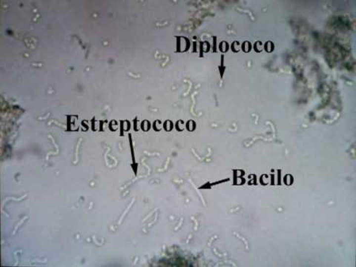 Bacterias del yogurt. Observación real al microscopio. Imagen portada