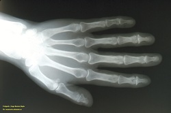 Radiografía de una mano Imagen portada
