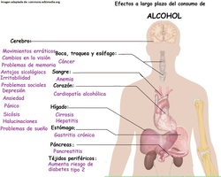 Imagen con información sobre los efectos a largo plazo del alcohol Imagen portada